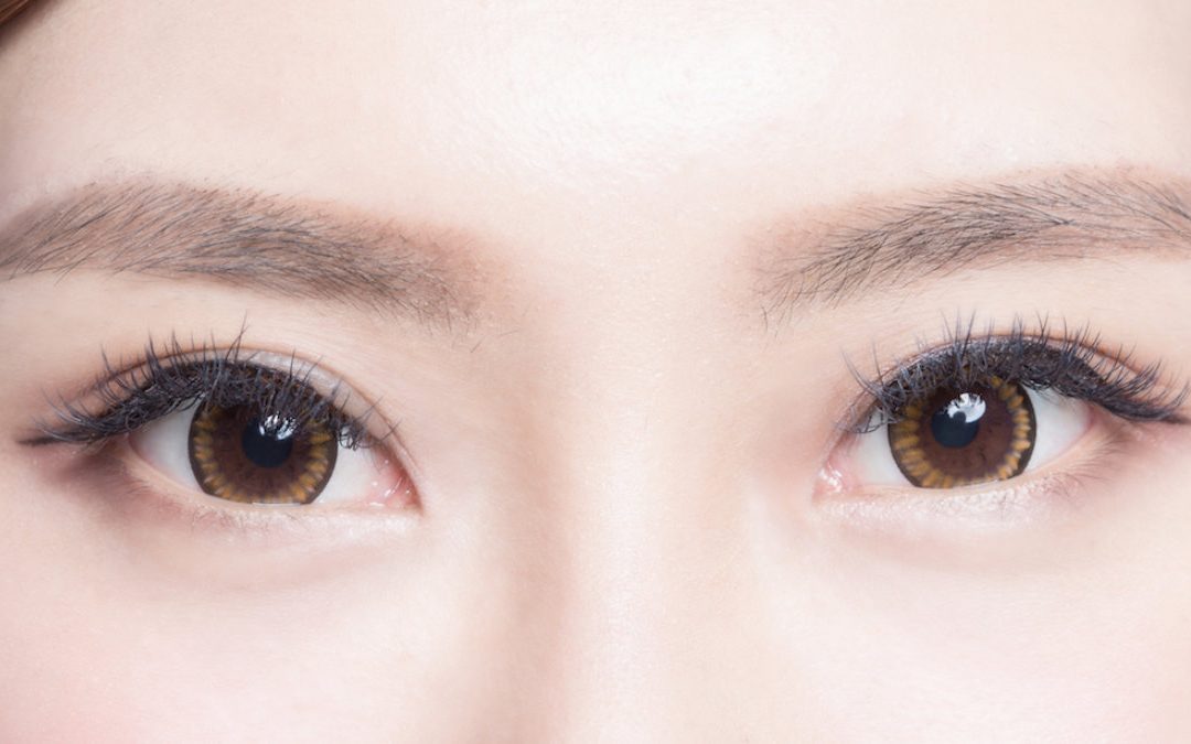 韓、日式訂書針雙眼皮手術